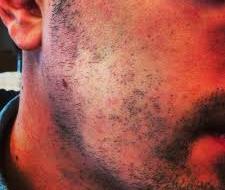 Beard man